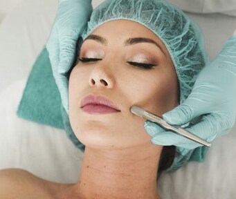 microneedling